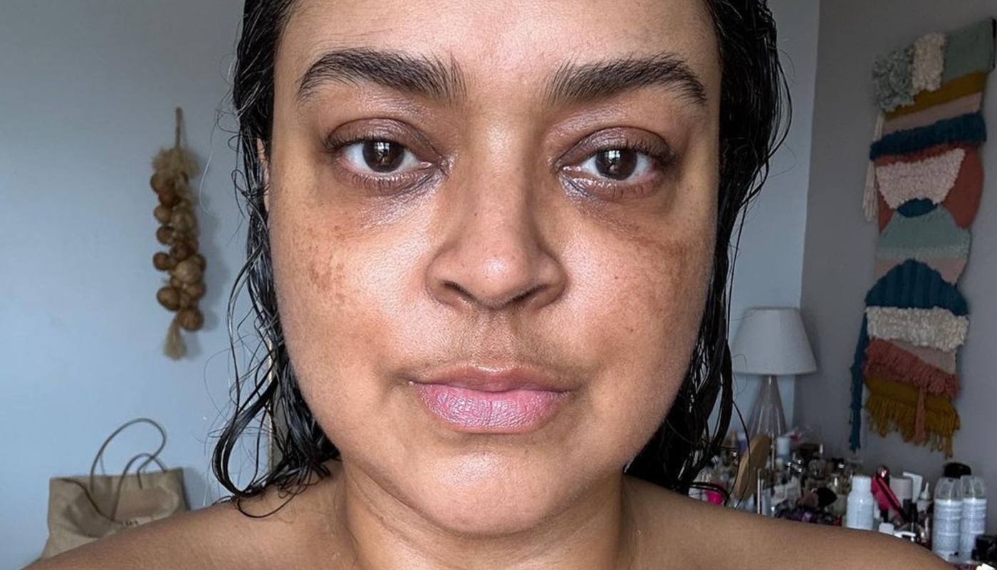 Preta foi diagnosticada com câncer em janeiro de 2022