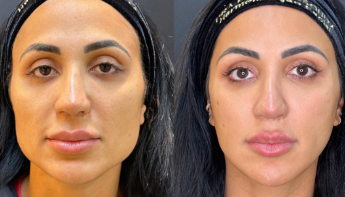 Antes e depois de Dayanne Bezerra
