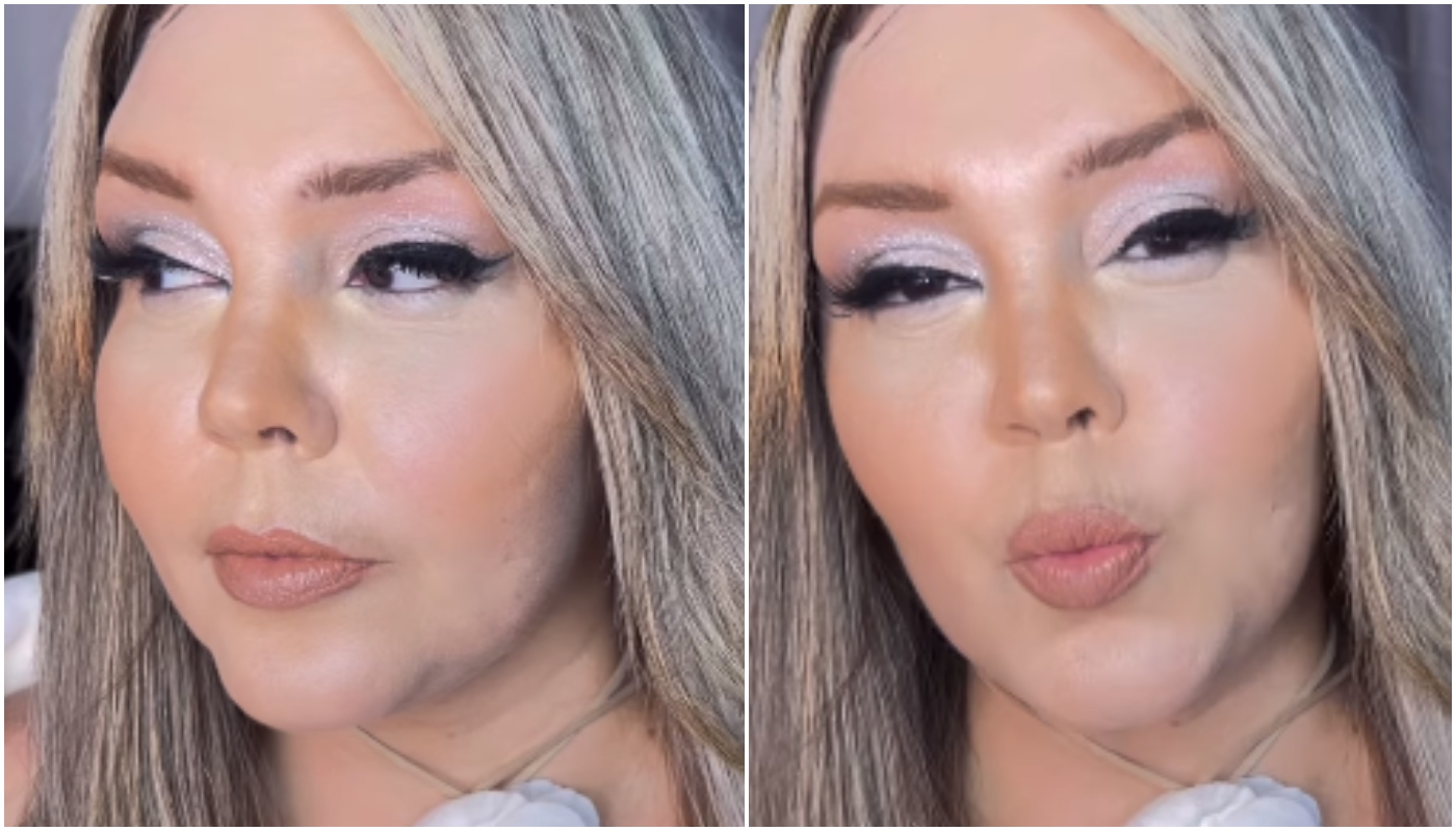 Simony afirmou estar inchada devido ao uso de medicações fortes